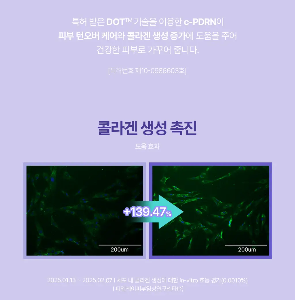 [모공PDRN/모공리프팅] 리쥬란 더마 힐러 포어 타이트닝 앰플 30ml 기획(앰플10ml+토너패드 2매*2ea) 상세페이지 25